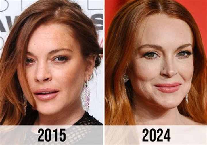 Unraveling The Truths Behind Lindsay Lohan's Surgeries: Discoveries And Insights